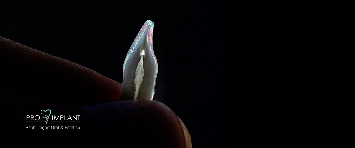 ProImplant | Reabilitação Oral & Estética