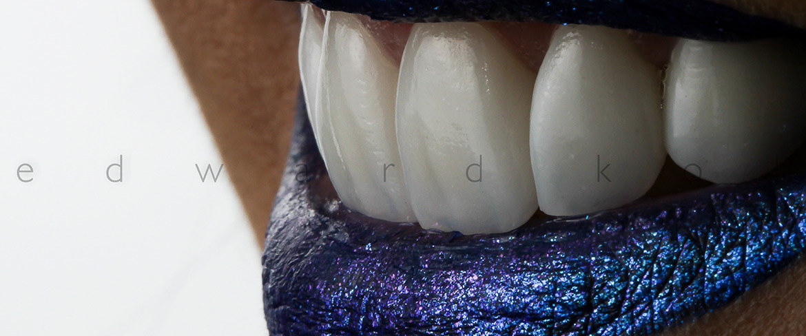 ProImplant | Reabilitação Oral & Estética