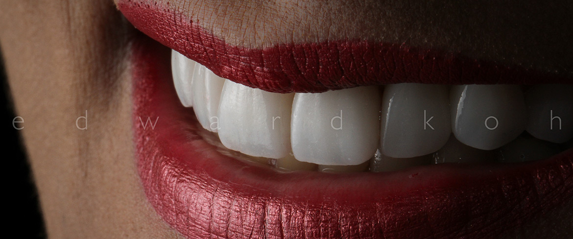 ProImplant | Reabilitação Oral & Estética