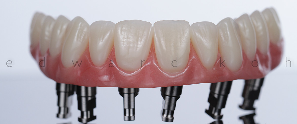 ProImplant | Reabilitação Oral & Estética