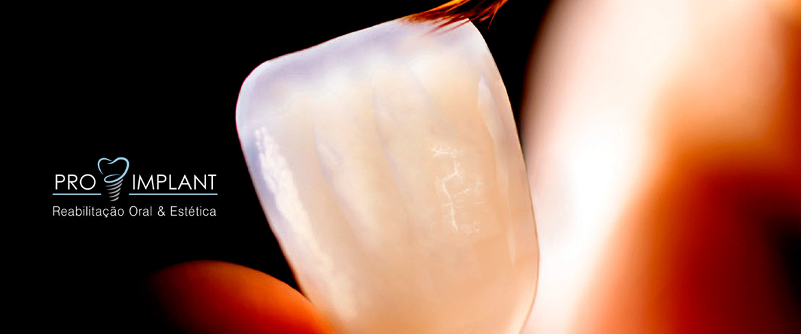 ProImplant | Reabilitação Oral & Estética