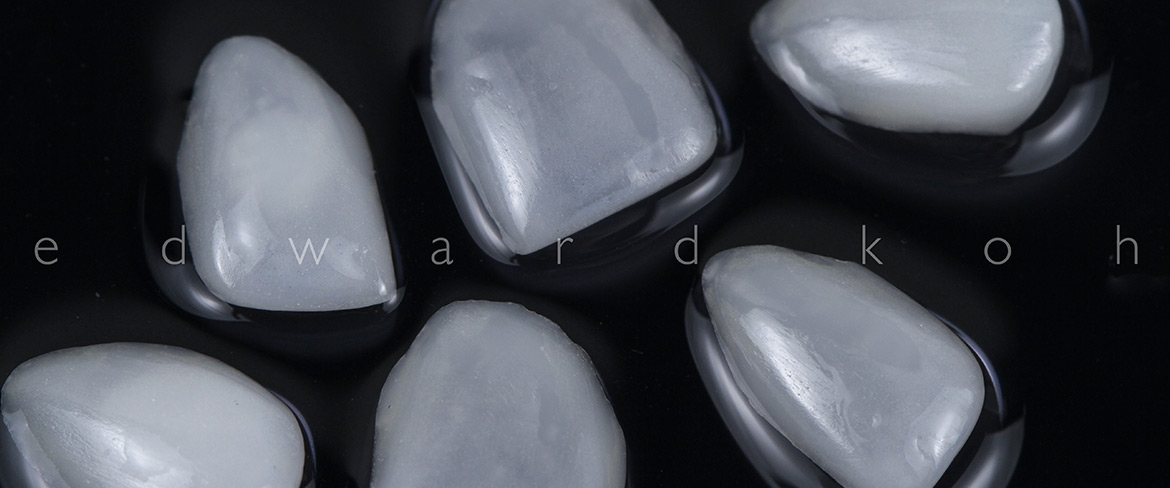 ProImplant | Reabilitação Oral & Estética