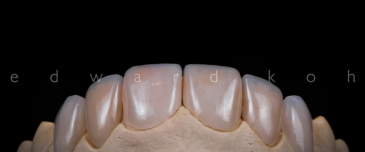 ProImplant | Reabilitação Oral & Estética