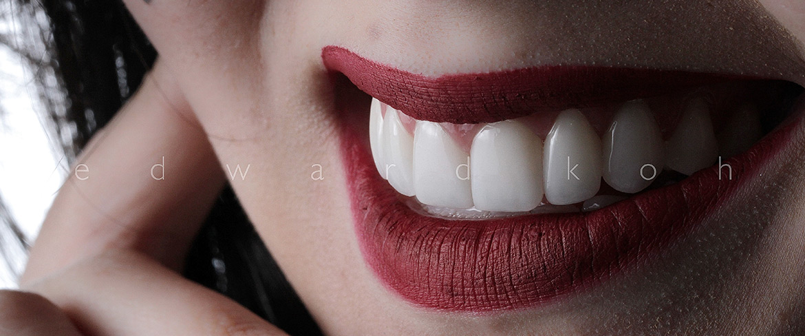 ProImplant | Reabilitação Oral & Estética