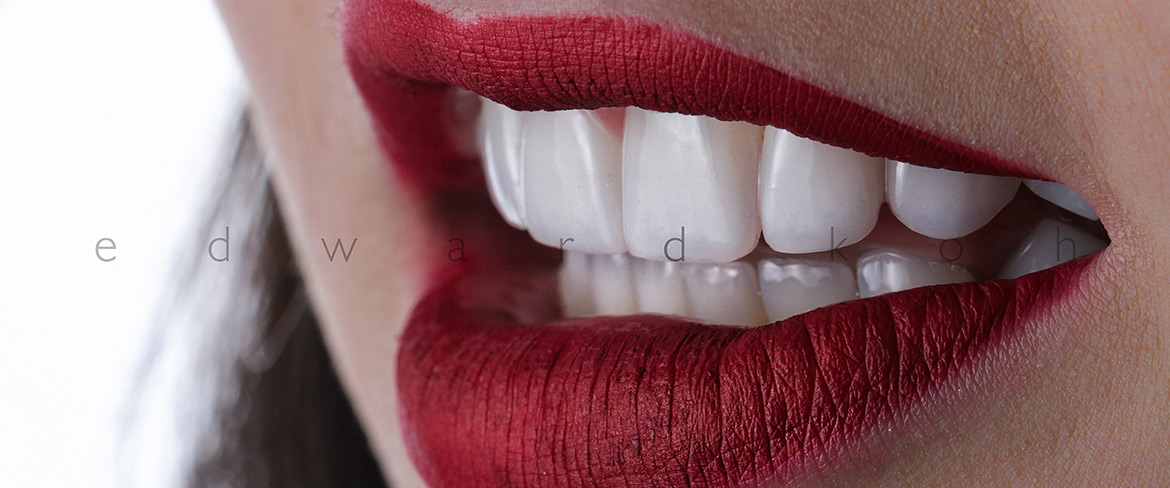 ProImplant | Reabilitação Oral & Estética