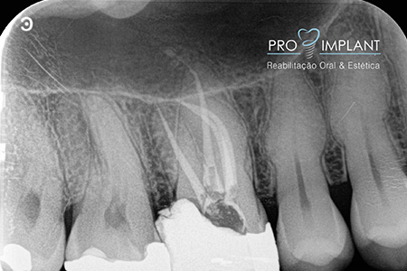 Endodontia