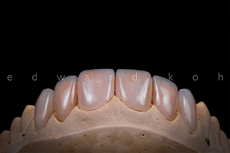 Estética Dental