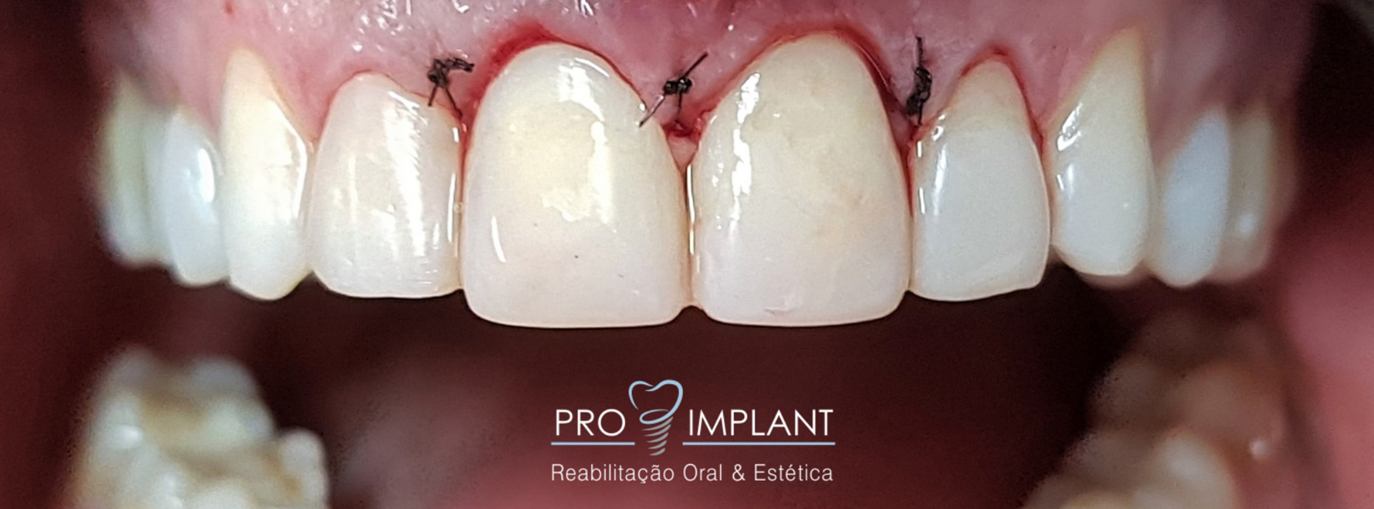 Periodontia