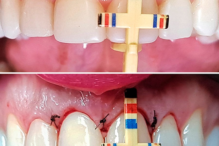 Periodontia