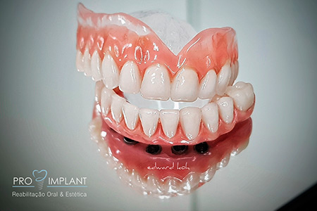 Prótese Dentária