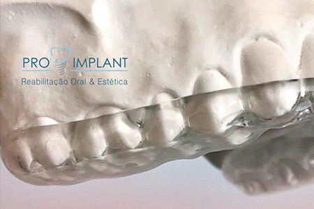 Tratamento de Disfunções de ATM