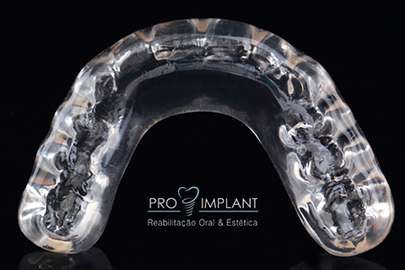 Tratamento de Disfunções de ATM