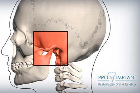 Tratamento de Disfunções de ATM
